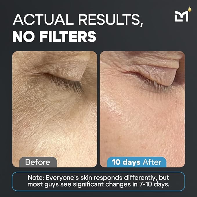 Titan Anti-Aging Mens Skin Care Kit – Cleanser, Face Serum for Men, Face Moisturizer – Skin Care for Men – Dark Spots, Wrinkles, Fine Lines – Vitamin C, Niacinamide, Ceramides, HA – Unscented