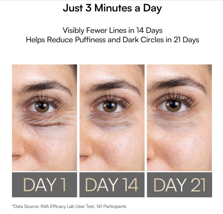 INIA Under-Eye Red Light Therapy for Face, 4-in-1 Beauty Device with Heat, Vibration, Massage & Red Light for Dark Circles, Puffiness & Skin Firming – Enhances Skincare Routin