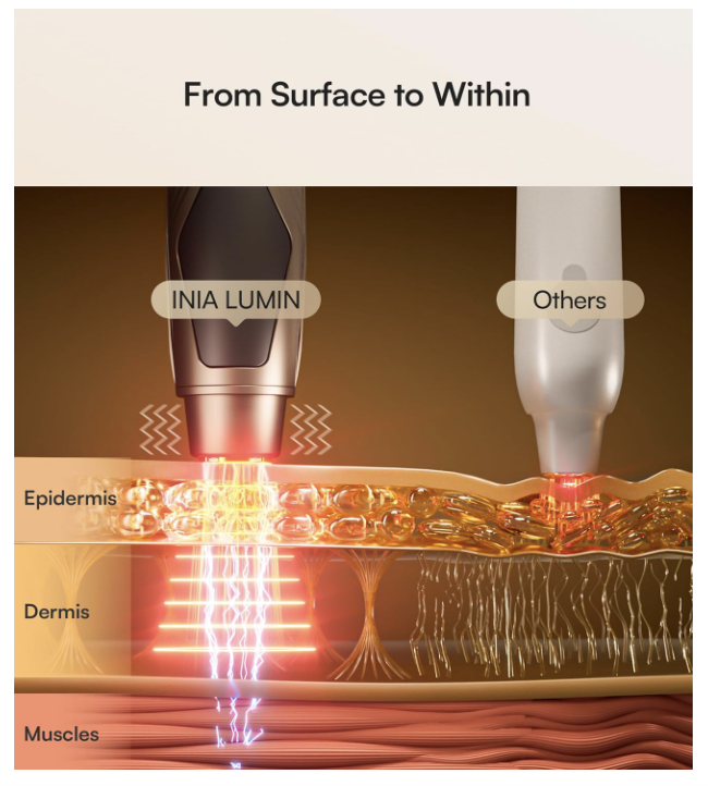 INIA Under-Eye Red Light Therapy for Face, 4-in-1 Beauty Device with Heat, Vibration, Massage & Red Light for Dark Circles, Puffiness & Skin Firming – Enhances Skincare Routin