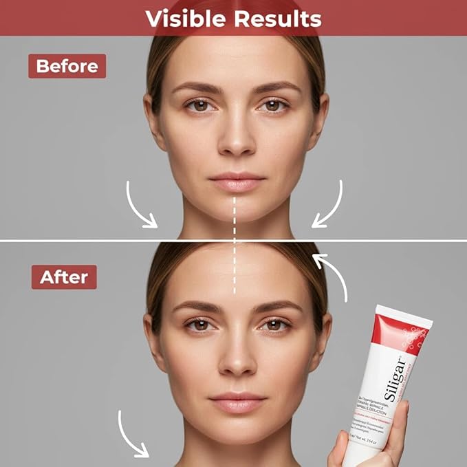 All In One Anti-Aging Cream – Reduces Wrinkles, Fine Lines, Dark Circles & Sun Damage – Retinol, Vitamin C, DMAE & Hyaluronic Acid – Fragrance-Free, for Men and Women life All Skin Types 75ml/2.54oz