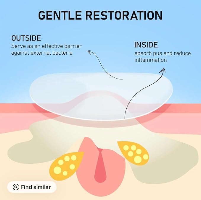 Splira™ Pimple Patches for Acne, Hydrocolloid Zit Stickers for Face, Invisible Blemish Spot Treatment, Overnight Acne Healing Hydrocolloid Patches, 360 Count