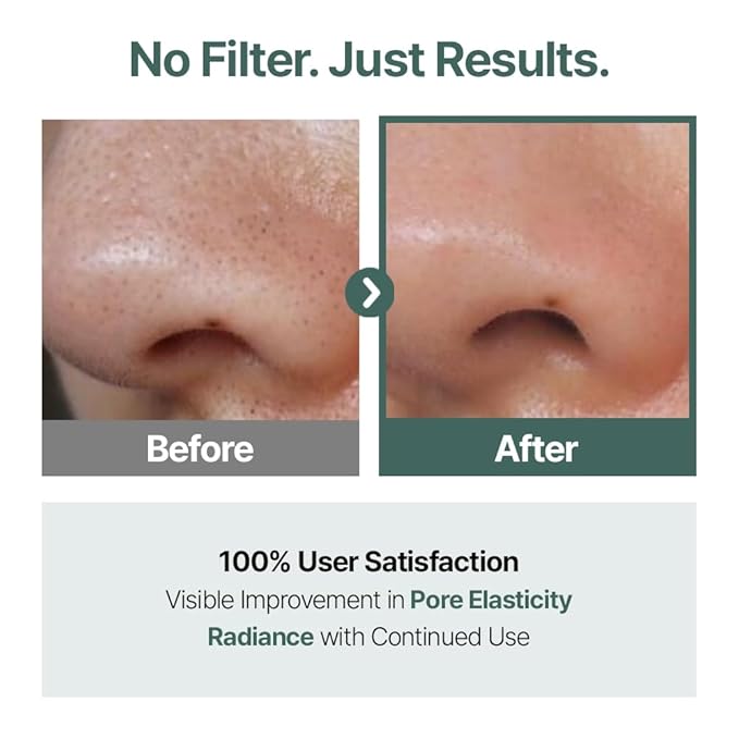 CELORABY Glow Recovery Skincare Bundle, Set of 2 – 5-in-1 Glass Skin Device and Exosome Toner Pads for Radiance, Hydration, Pore Care, and Skin Texture Refinement | Korean Beauty at Home