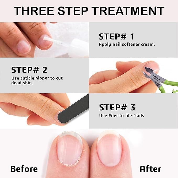 Professional Cuticle Trimmer Nail Cuticle Cutter Stainless Steel Cuticle Nippers with Sharp Blades of Cuticle Remover Clippers Manicure Tools Double Spring for Nail Care Pedicure Nail Tools (Multi)