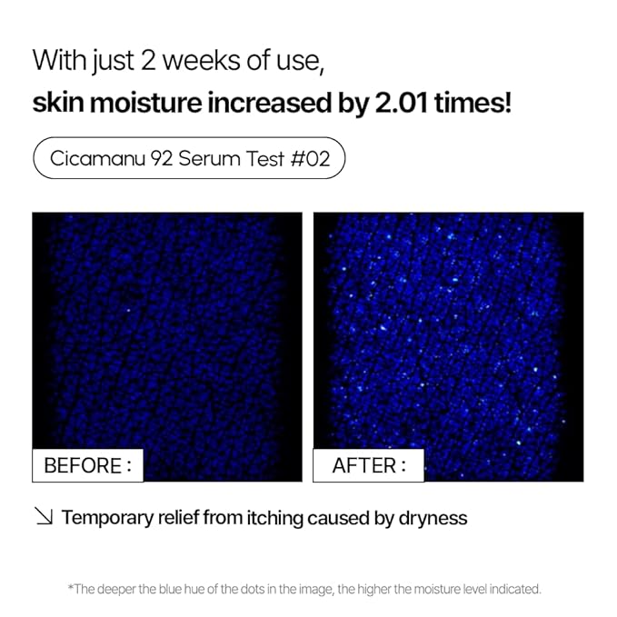 Parnell Cicamanu 92 Serum (1.01 Fl Oz) 30ml | Melatonin, Centella Asiatica | Ceramide for Overnight Recovery & Soothing Irritated Skin | Targets Hyperpigmentation & Deep Hydration | Korean Skin Care