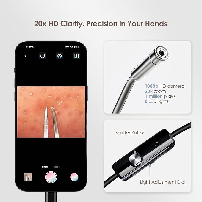 Luma 1 Visual Black Head Remover Tweezers with Camera - Pimple Popper Tweezers with Camera 20x Magnification, 1080P, 8 LED Lights, Dolphin Design Non-Magnetic Tweezers, Pore Cleaner