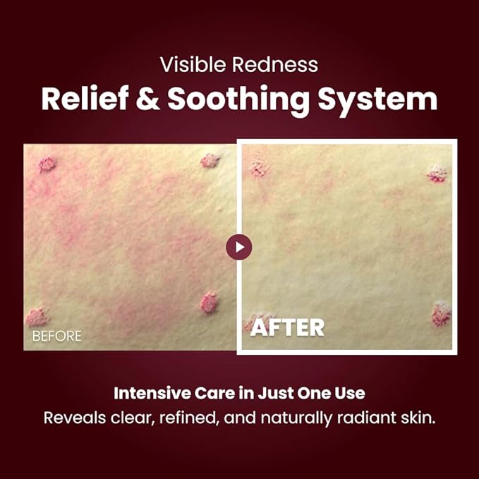 KOPHER Curepair Melder SOS Cream [4ever Edition] –Peptide Repair Night Cream for Radiance, Recovery & Post-Procedure Care | Advanced Skincare for Home Use | Dermatologist Co-Developed Formula