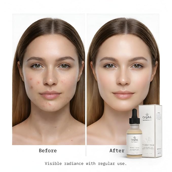 Orphi Radiance C Vitamin C Face Serum – Fragrance-Free Facial Serum with Hyaluronic Acid, Ferulic Acid & Vitamin E | Brightening & Anti-Aging Skincare for Women & Sensitive Skin | Made in USA
