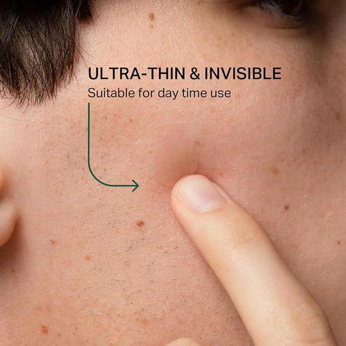 Y’OUR Improving Acne Patches: Ultra-thin Hydrocolloid Pimple Patch for Face; Purifies & Alleviates Stubborn Blemishes, Promotes Healing, Effective Zit Treatment. Made in USA. 56 Count