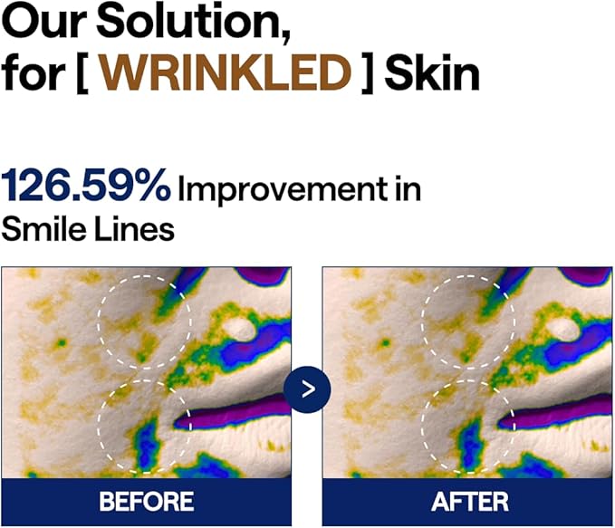 MEDIHEAL Toner Pads [Retinol] - Collagen Lifting Pad for Skin Rejuvenation & Firming - Lifting Pads for Enhancing Skin Texture - Vegan Stretchable Lifting Fabric (100 Count)