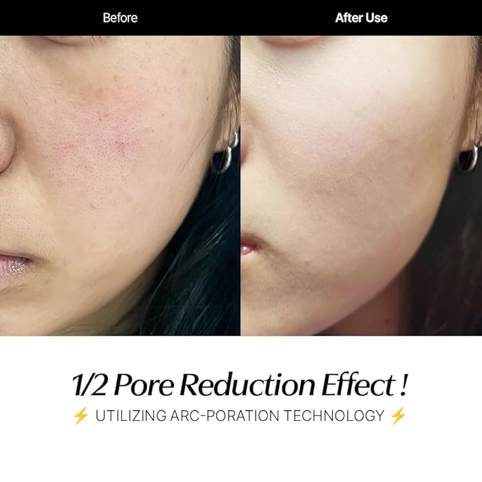 CELORABY Anti-Aging Bundle – 5-in-1 Glass Skin Device + 4GF Serum for Fine Lines, Firmness, Enhanced Absorption, Korean Skincare at Home