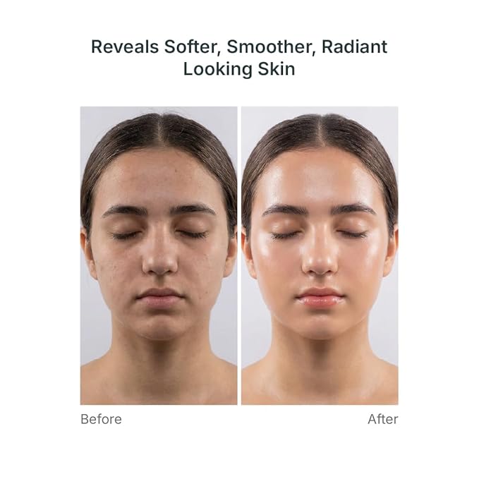 MYOLIFT Cell Renewal Peptide Mask(EGF)– 100%Vegan, Bio-Cellulose FaceMask for CellRenewal, Skin Firming, Hydrating & Brightening-with Niacinamide, Hyaluronic Acid& EGF|Korean Skincare Sheet Mask–Pack5