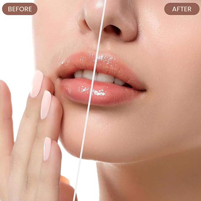 Facial Hair Remover for Women – Electric Face Razor with Light, Hair Removal for Upper Lip, Chin & Cheeks – Color Champagne