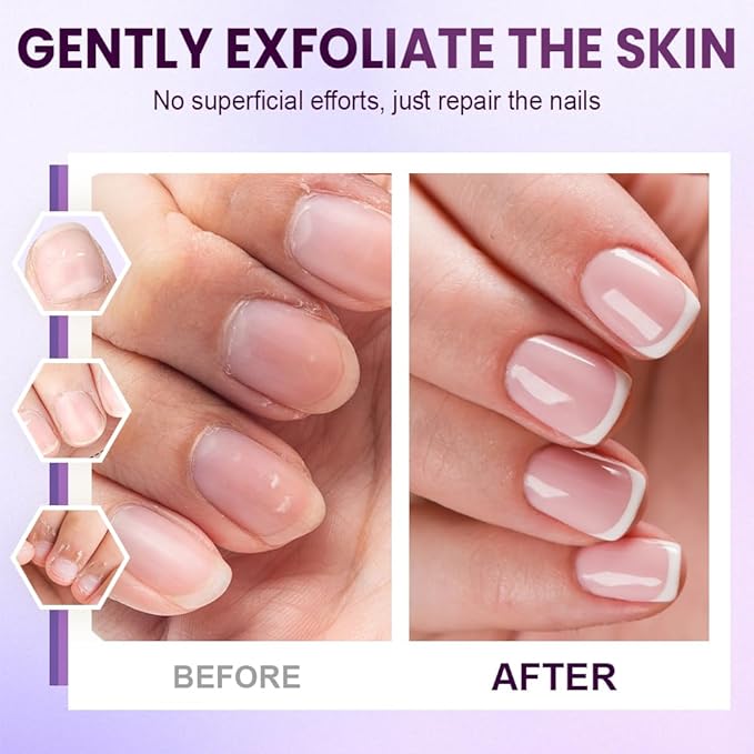 Yilia 3-in-1 Nail Care Pen, Cuticle Oil Pen & Pusher with Ceramic Tip, Moisturizes, Strengthens & Brightens Nails (3 Pack)