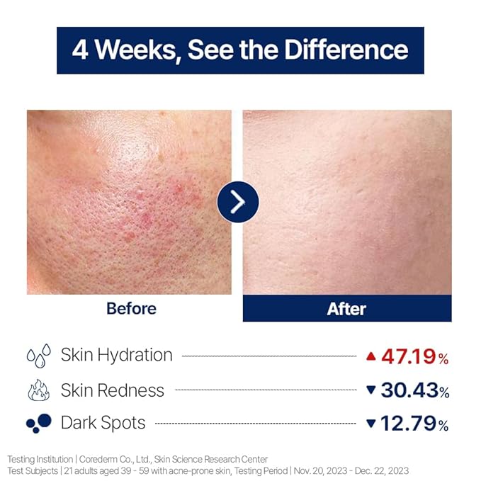 CELORABY Anti-Aging Bundle – 5-in-1 Glass Skin Device + 4GF Serum for Fine Lines, Firmness, Enhanced Absorption, Korean Skincare at Home