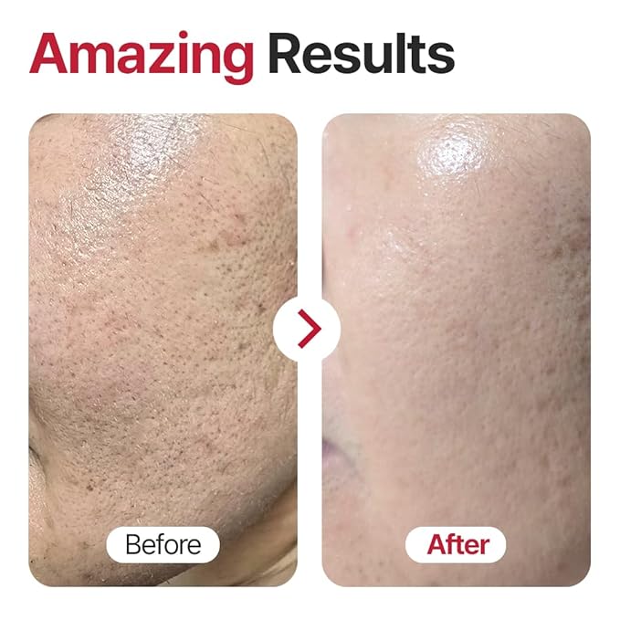 Lift Up Light Cream, 50g — K-Beauty Firming & Hydrating Face Cream with Centella, Hyaluronic Acid & Plant Extracts