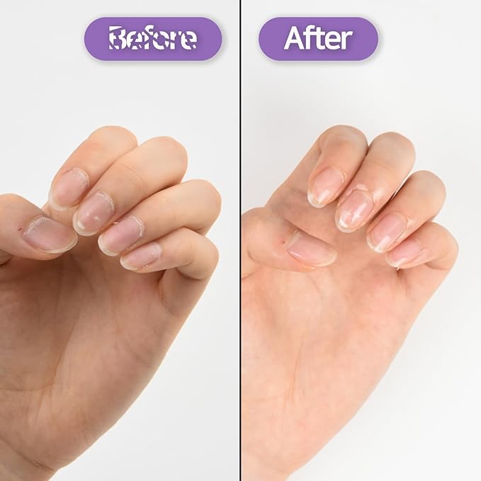 Baren Nail & Cuticle Oil Repair Essence Pen | Easy Pen Type | Strengthener for Damaged Nails | Korean Celebrity Nail Care Secret | Nail Growth Treatment with JoJoba Oil, Almond Oil, Vitamin E