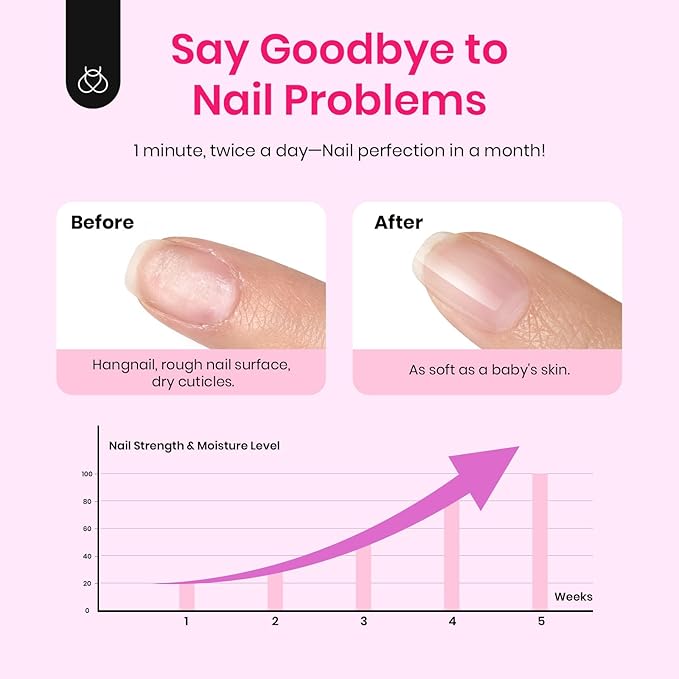 Beetles Cuticle Oil For Nails - 20ml Nail Care Strengthener Oil Stronger Nails Spa and Hand Manicure Essentials Damaged Cuticles for Repaired Thin Nails Nourish Home Nail Gfit for Women