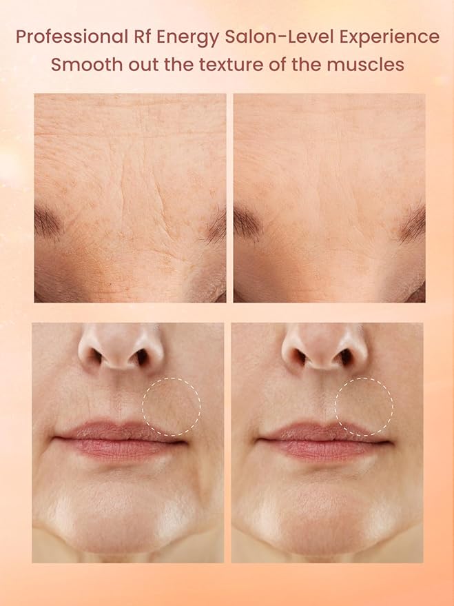 Radio Frequency Skin Tightening Device, Professional Wireless Home RF Face Machine for Anti-Aging, Wrinkle Reduction, Lifting, Firming with 3 Levels