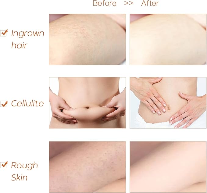 ICANdOIT Dry Brushing Body Brush-Stiff Sisal Bristles Dry Skin Brush,Exfoliating Massage Brush for Cellulite and Lymphatic,Improve Circulation,Stop Ingrown Hairs,Reduce Acne,Soften Skin