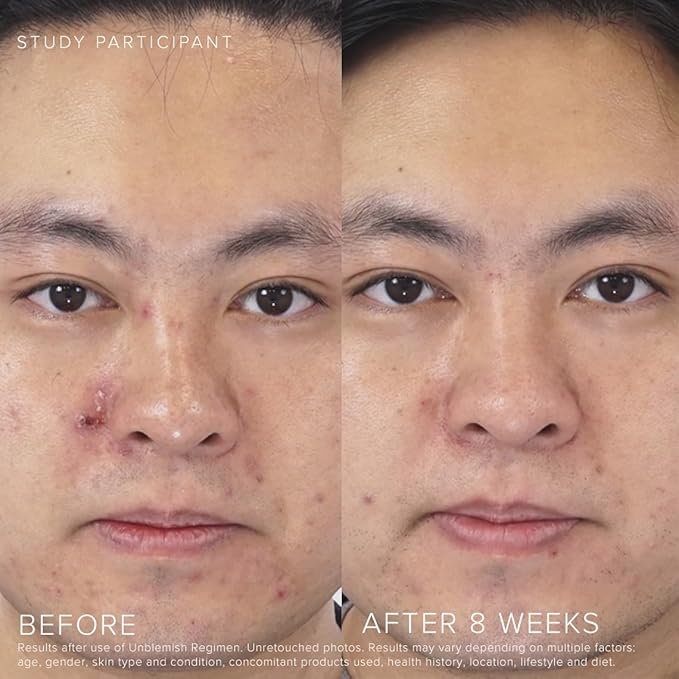 Rodan + Fields UNBLEMISH Invisible Matte Defense Broad Spectrum SPF 30 | Skincare Moisturizer | UV Skin Protection | Sunscreen Face and Neck Cream