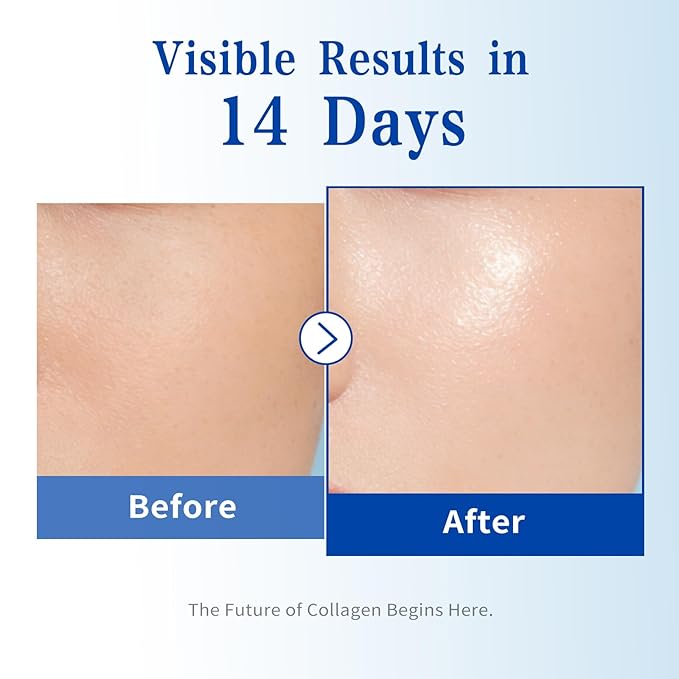 6X Collagen Peptides Serum for Face – Triple Collagen, Matrixyl 3000, Centella & Ectoin – Anti-Aging Facial Serum for Firming, Smoothing & Hydration | 30e x 0.05 Fl.oz (30 x 1.5ml)