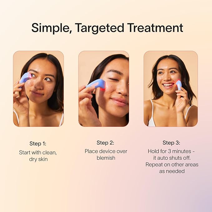 Solawave Bye Acne Spot Treatment | Blue & Red Light Therapy Device for Pimples & Zits | Face Wand Reduces Inflammation, Redness, & Appearance of Blemishes | 3-Min Sessions at Home for Clearer Skin