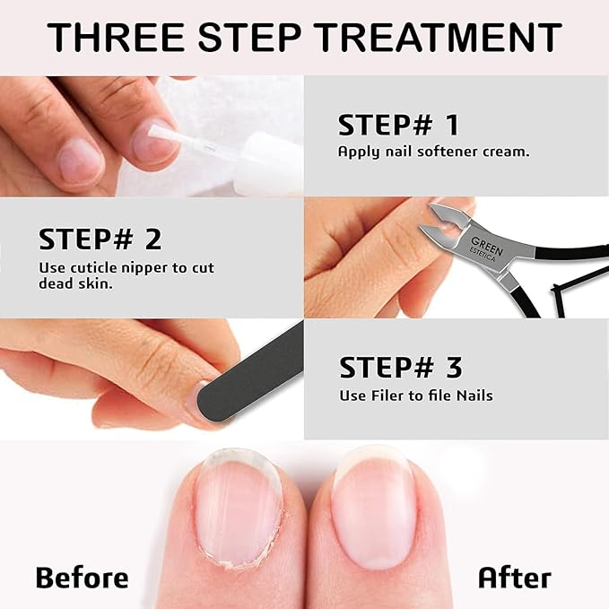 Professional Cuticle Trimmer Nail Cuticle Cutter Stainless Steel Cuticle Nippers with Sharp Blades of Cuticle Remover Clippers Manicure Tools Double Spring for Nail Care Pedicure Nail Tools (Black)