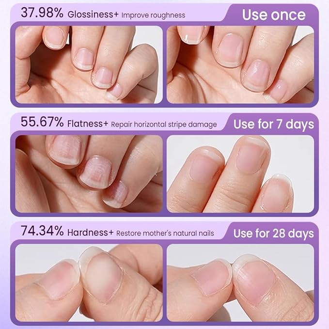 Yilia 3-in-1 Nail Care Pen, Cuticle Oil Pen & Pusher with Ceramic Tip, Moisturizes & Strengthens Nails (1 Fl Oz)