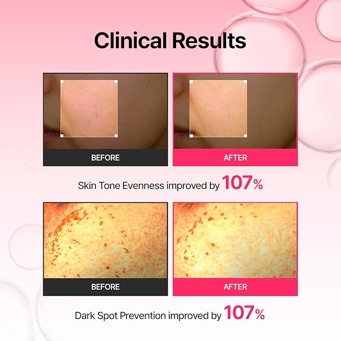 MEDITHERAPY Arbutin Skin Booster Serum for Face 5.07 fl. oz - Korean Face Serum with 10% Niacinamide and 2% Arbutin - Alpha Arbutin Targets Dark Spot, Evens Skin Tone - Gentle on Sensitive Skin