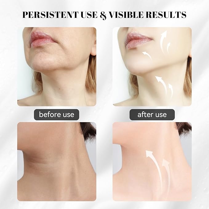 Facial Sculptor with Red Light Therapy, Microcurrent & Vibration Massager, Portable Anti-Aging Device for Face and Neck Care, Wrinkle Reducer Face Lift Tool (White) – Valentine’s Gift