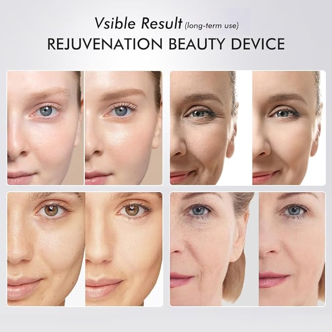 Skin Tightening Face Machine, Face Massager Tool with 5 Modes, Enhanced Absorption, Facial Neck Lifting, Firming and Pore Care