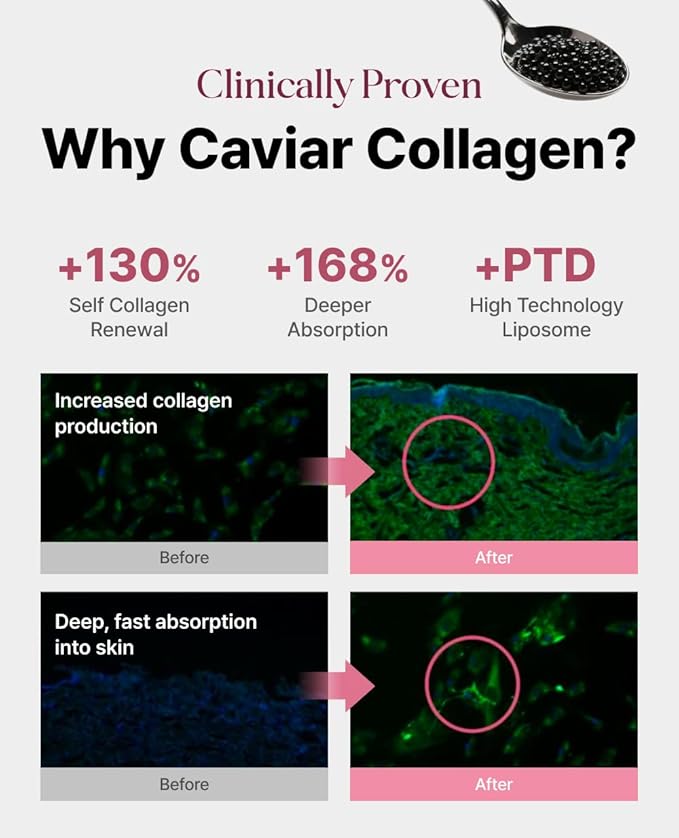 Delere Caviar Glow Smoothing Serum | Caviar Collagen with Niacinamide and Retinol for Face | Korean Serum for Glowing Skin and Radiant Glass Skin, 1.7oz