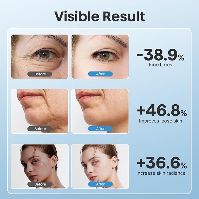 Red Light Therapy for Face, 3 Mode Face Massager Tool with Heating Vibration for Skin Care, Wrinkle Reducer Facial Massager to Soothe and Relax Skin, Micro-Current Face Beauty Device (AM-810B)