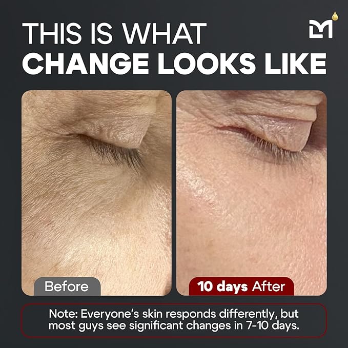 Titan MAX Anti-Aging Peptides Serum for Face – Utra Potency Mens Peptide Serum Moisturizer – Skin Care Men – Face Serum Men – Anti Aging Serum – 10% Niacinamide, HA – All Skin Types–Unscented