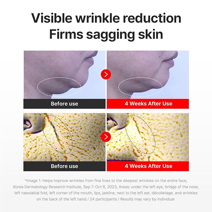 CENTELLIAN 24 Madeca Cream Time Reverse (50ml/1.69fl oz, Pack of 2) Advanced Fast-Absorbing & Nourishing Cream, Hydrates, Reduces Wrinkles, Korean Skin Care, Centella Asiatica