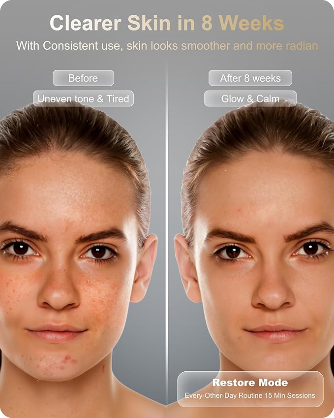 Lumefu Nimbus FDA-Cleared Red Light Therapy Mask For Anti-Aging & Anti-Acne With 3 Treatment Modes Red, NIR & Blue LED Light, Portable 3D Facial Device Comfort Fit, Cordless Skin Care At Home