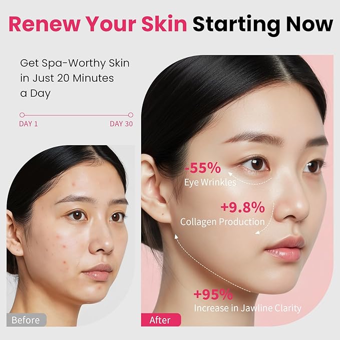 Face Lift Device – 8 in 1 Skin Tightening and Lifting, LED Light Therapy for Wrinkles, Korean Skin Care, Spa-Grade Facial Massager Lifting & Firming Beauty Massager (Black)