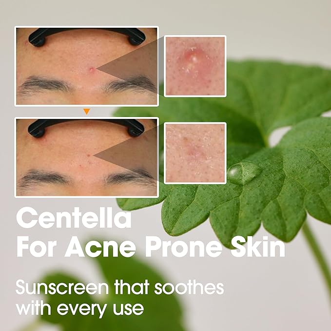 SOME BY MI V10 Hyal Air Fit Sunscreen SPF 50 – 1.69oz, 50ml – Korean Centella Sunscreen for Face with UV Protection – Non-Greasy, No White Cast, No Eye Irritation for Sensitive Skin – Korean Skin Care