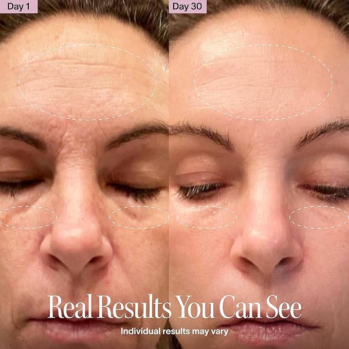 Solawave 4-in-1 Radiant Renewal Facial Wand | Red Light Therapy for Face and Neck | Galvanic Skincare Wand & Facial Massager | Anti-Aging Wrinkle Reduction | Solawave Original | Matte Black