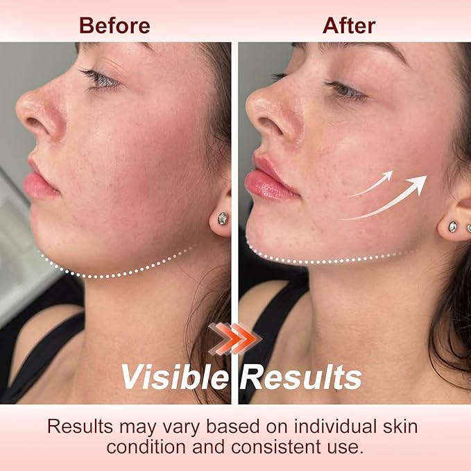 Face Lifting Facial Massager, Vacuum Suction for Face, Red Light Therapy Portable Face Lift Device for Skin Care Tightening Firming Skin Care Tools for Toning, Glow Boost