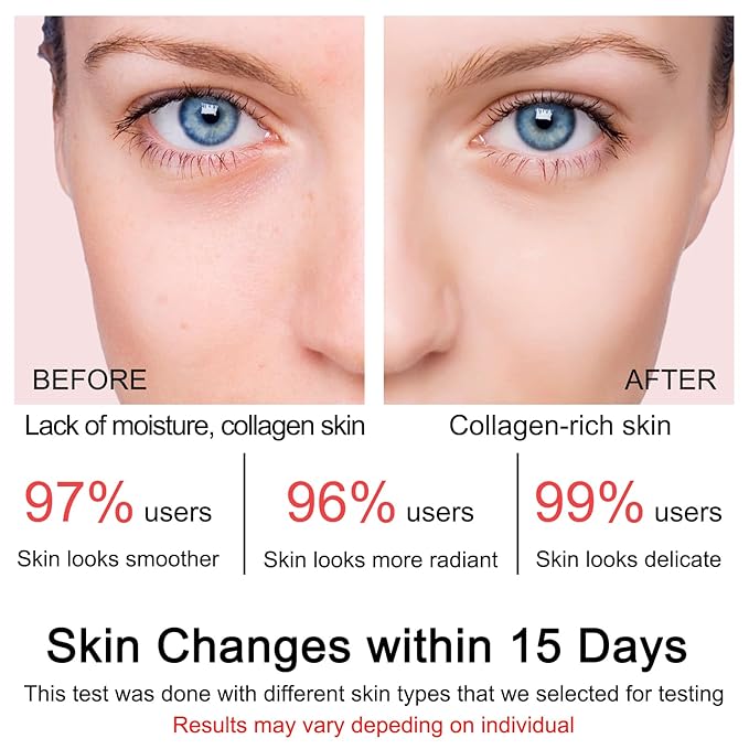 Collagen Jelly Cream - Contains Niacinamide & Freeze Dried Hydrolyzed Collagen -Elasticity & Hydration - Reduce Fine Lines & Dullness - Korean Glass-Shiny Skin Suitable for All Skin Types (3.38 Fl.Oz)