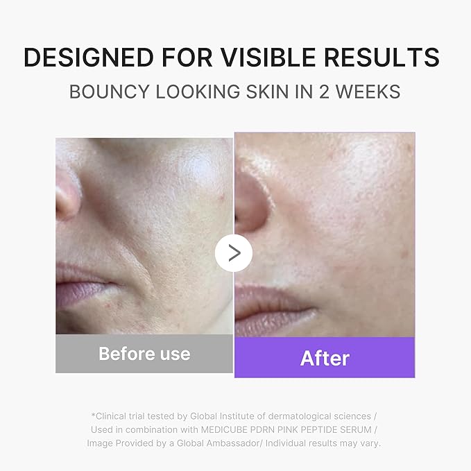 medicube Booster Pro Mini Plus | Facial Device for Radiance, Calming, and Elasticity | Red, Blue, Purple 3-Mode | Portable Korean Skincare Device, At Home Care | Beige