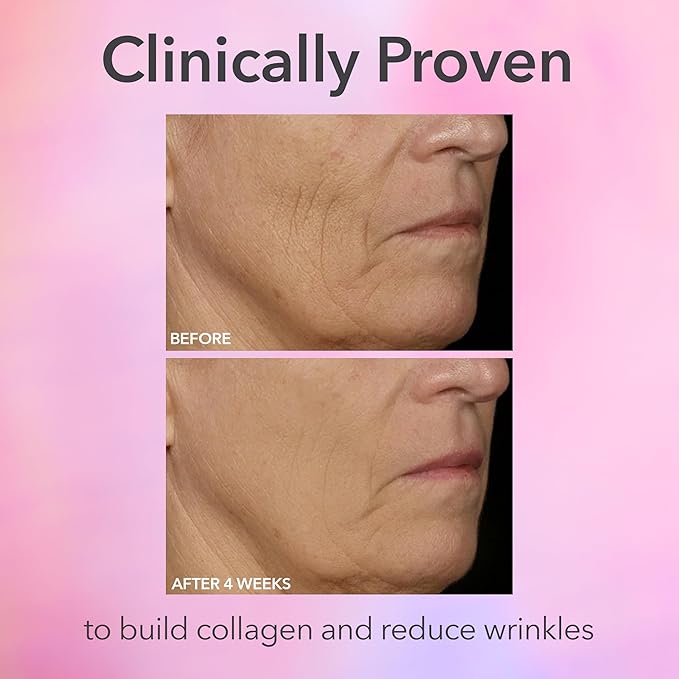 Dr. Dennis Gross DRx SpectraLite FaceWare Pro – LED Face Mask for Skin Rejuvenation with Dual Red & Blue Light Therapy, FSA HSA Eligible