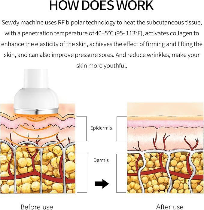 High Frequncy Skin Care Beauty Device Skin Tightening Facial Machine Face Neck Device Body Massager Tools Device Geneo X Elite Micro-Current Wrinkle Reduction Facial Service.Model EP-400