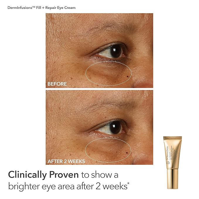 Dr. Dennis Gross Fill, Plump & Firm Kit – DermInfusions™ Hyaluronic Acid Serum, Eye Cream & Lip Treatment | Boost Hydration, Smooth Fine Lines & Enhance Volume | $125 Value Limited Edition Gift Set