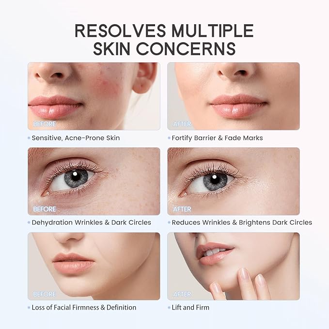 LULUROSE Facial Massager with Cold Heat Light Vibrating for Face,Facial Device with LED Display for Skin Care Wrinkles at Home Traveling,1500mAh