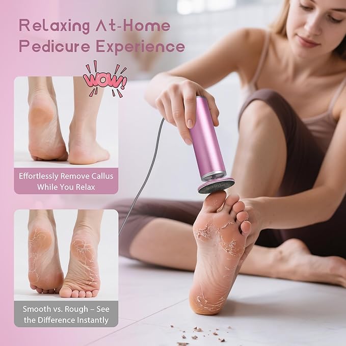 Electric Foot Callus Remover with 60pcs Sandpaper Discs, 4.8IN Aluminum Foot File for Dead Skin and Cracked Heels, 800RPM Professional Pedicure Tool for Home Spa Use