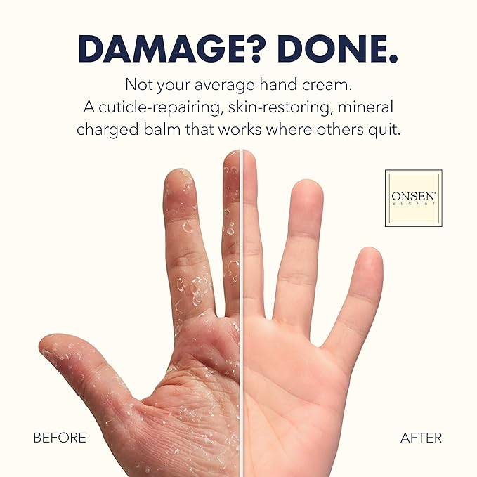 Onsen Secret Essential Nail Reboot Kit with Hand & Cuticle Rescue Cream | Buffer Block, Professional File, Replacement Pads and Repair Cream for Strong, Healthy, Shiny Natural Nails at Home