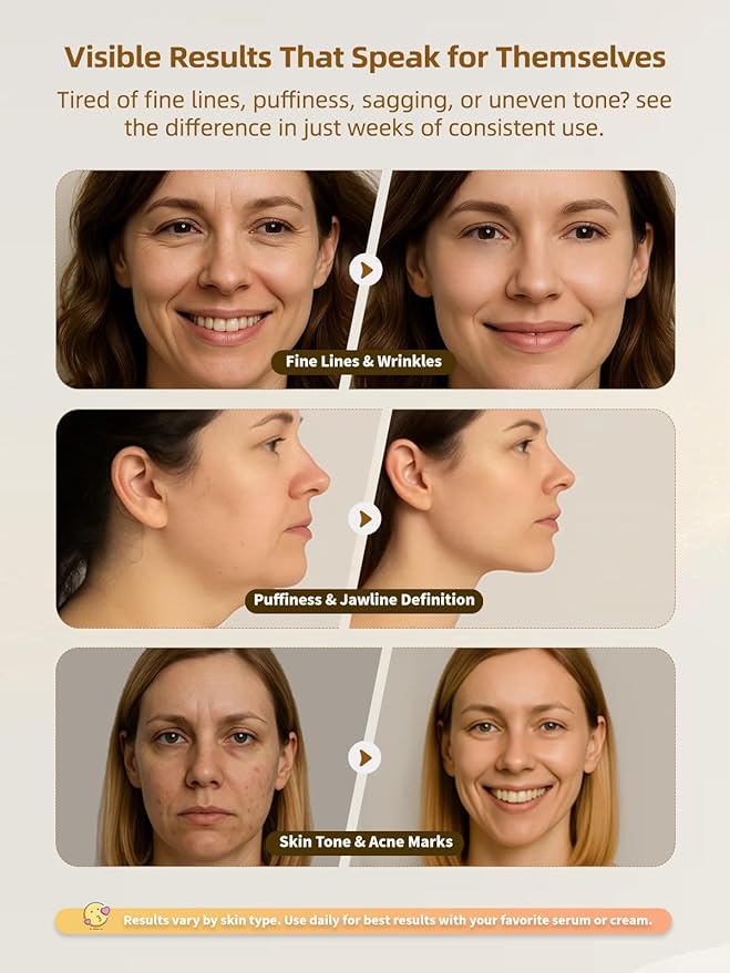 6-in-1 Age-Defying - Eye, Face & Neck Lift & Firm, 5-Color Light Therapy for Face with Microcurrent, Vibration, Heat & Cooling, Skin Care Tool for Youthful & Tightening Skin (White)