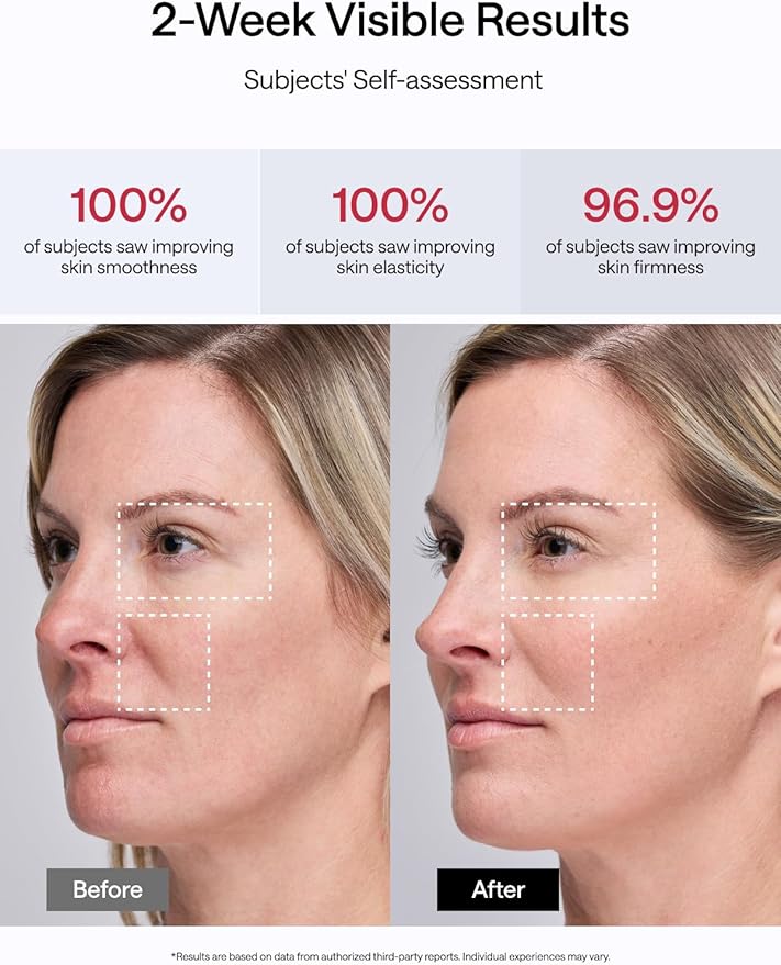 JMOON Face Lift Gift Collection, Microcurrent Facial Device, Medical Grade Red & Infrared Light Therapy for Face, Lifts, Firms, Smooths Wrinkles with 4 Modes & 5 Intensity Levels